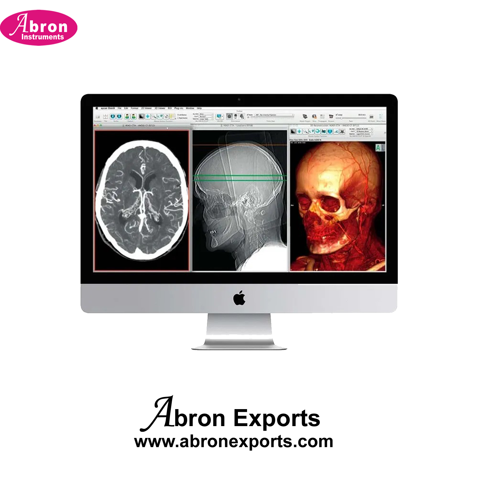 X-Ray Workstation Colour Screen For Viewing Radiology Centers Apple Abron ABM-2786W 